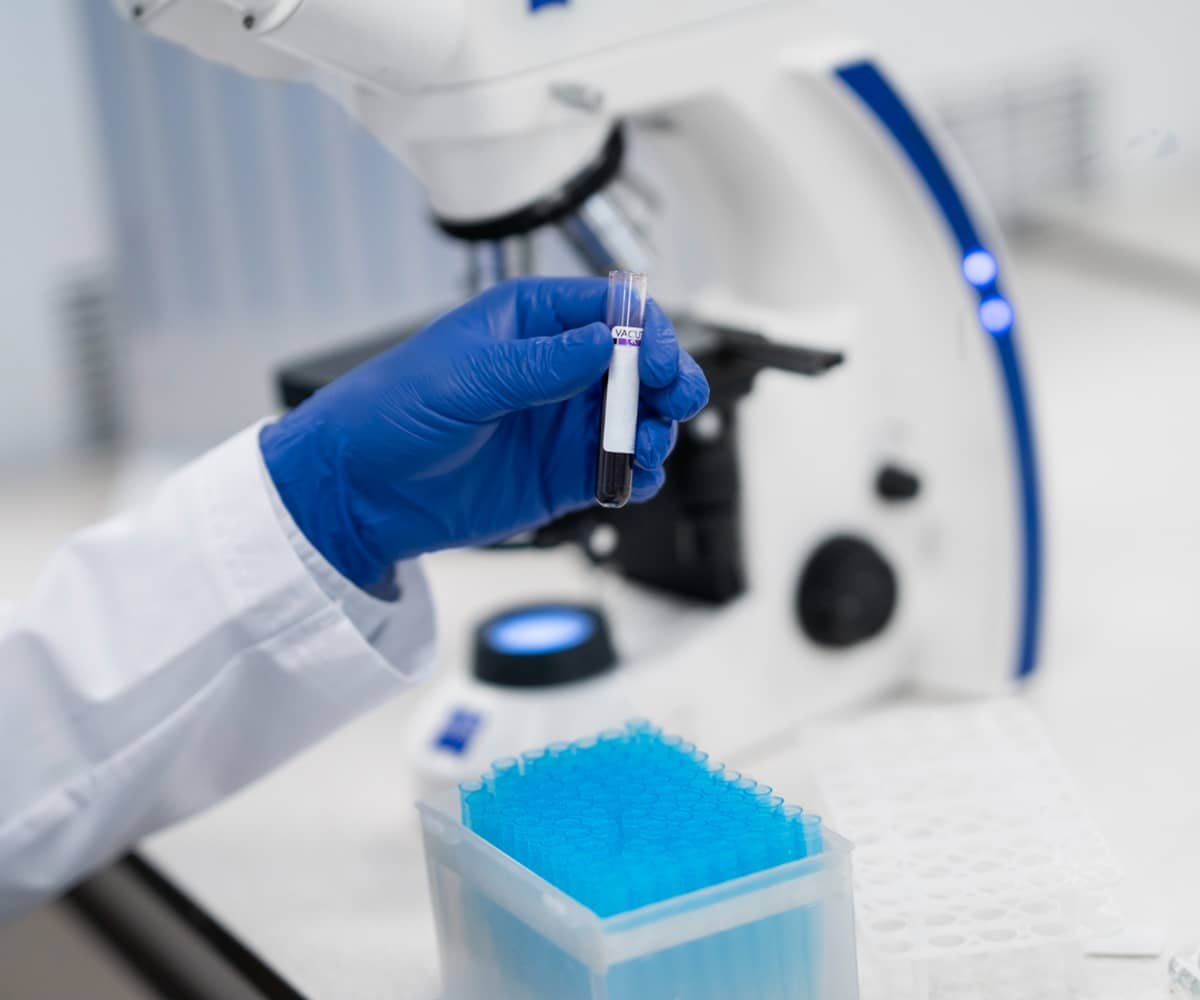 Monitoring Lab Test A Guide for Remote Patient Monitoring in a Lab ...